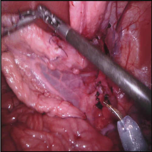 Surgical instruments raw scan
