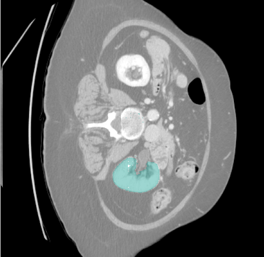 Abdominal organs prediction overlay