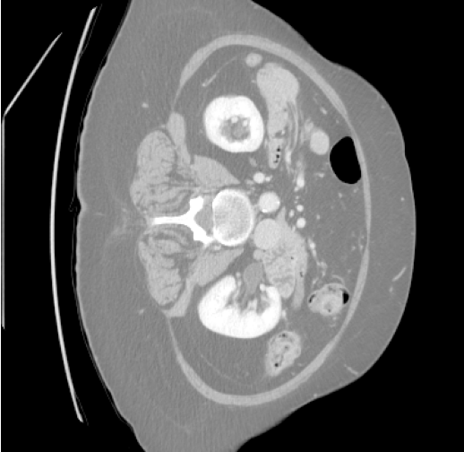 Abdominal organs raw scan