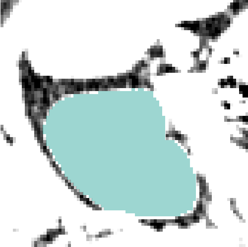 Kidney prediction overlay